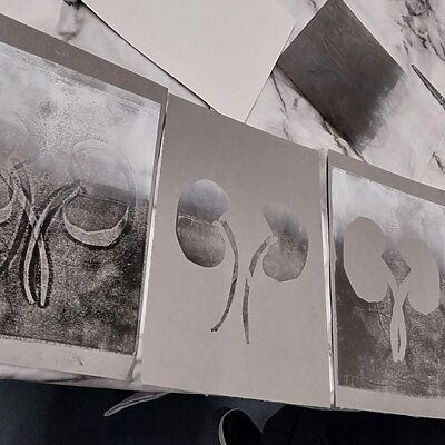 artwork produced by young renal patients at art workshop